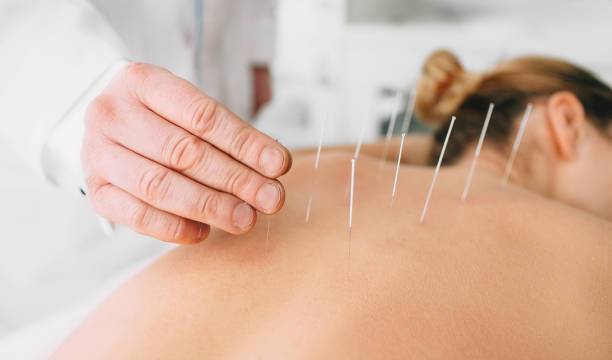 Best acupuncture centers in Kelowna, BC